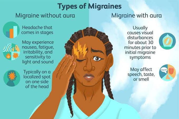 Migraine