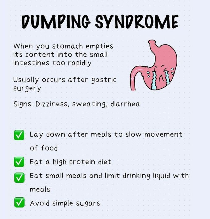 Dumping Syndrome