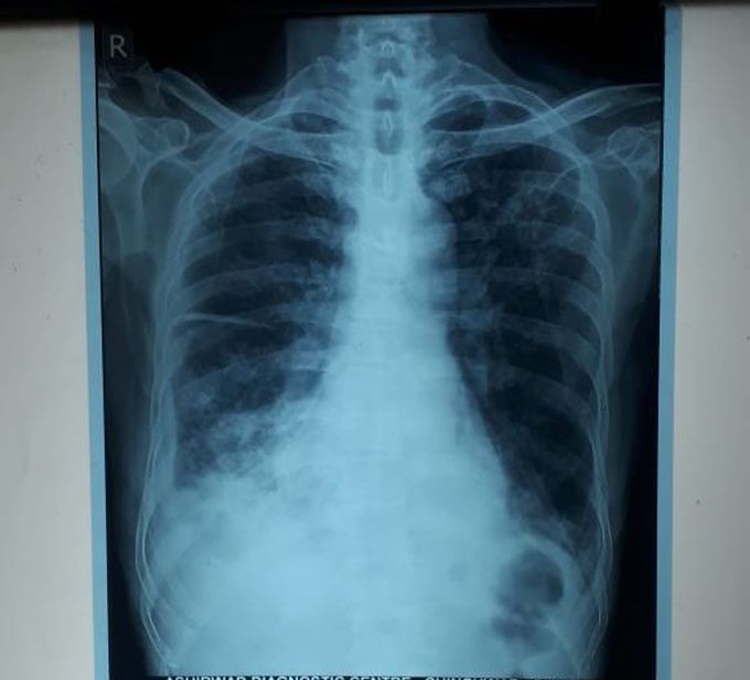 How will you treat this patient???