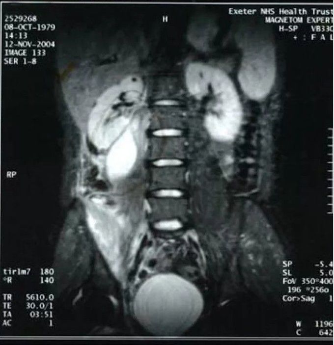 general trauma surgery