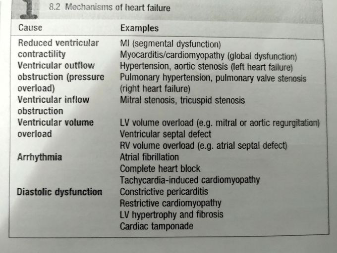 Different types of heart failure...