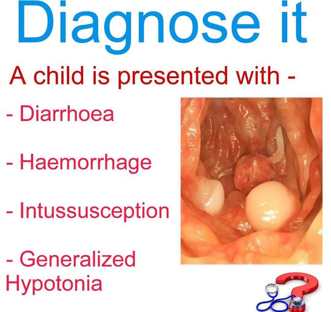 Dignose it!
