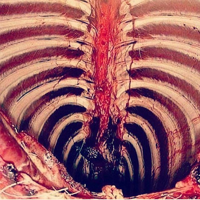 Inside chest wall