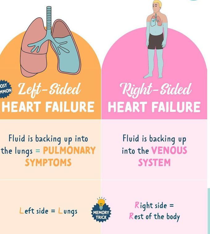 Congestive Heart Failure