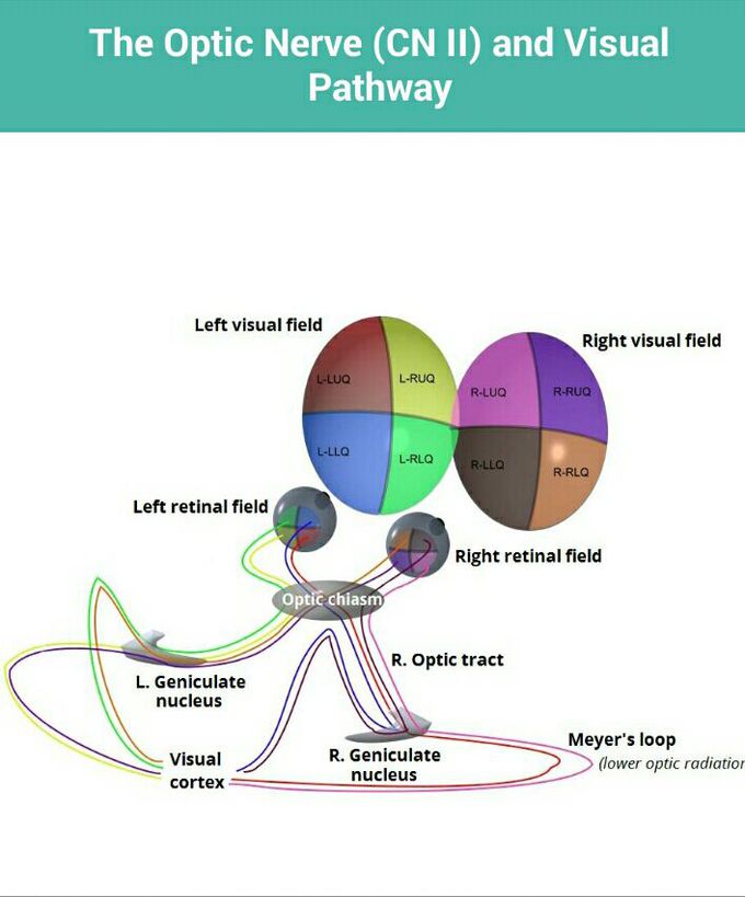 Optic pathway