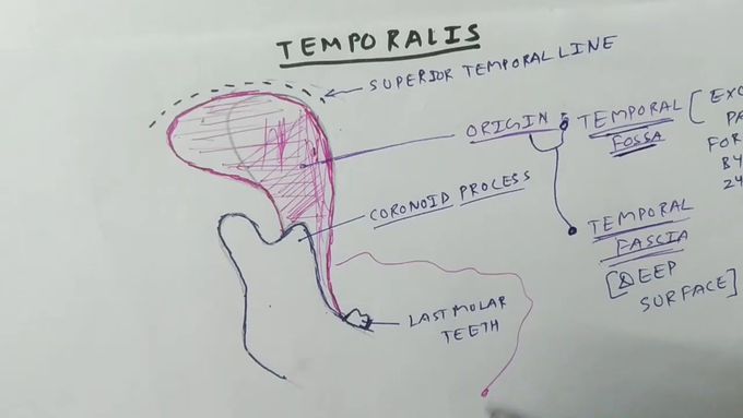Muscle of mastication ( Temporalis )