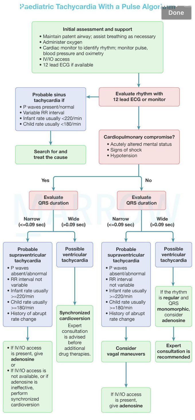 Paediatric Tachycardia