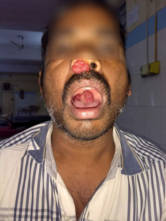 Clinical diagnosis?