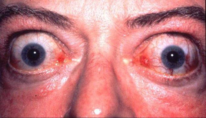 Diagnosis?