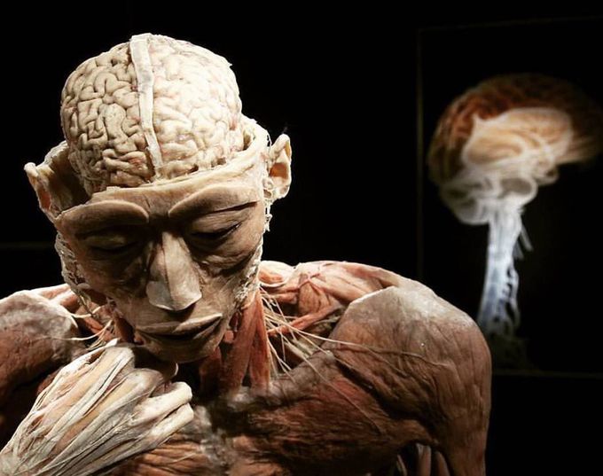 Cadaver