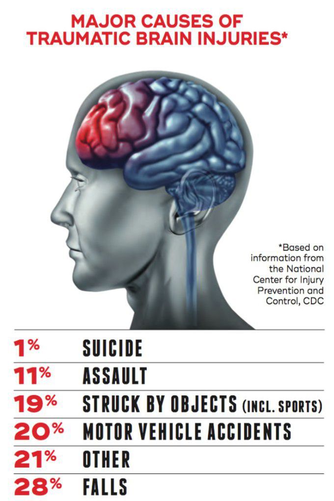 Major causes of traumatic brain injury