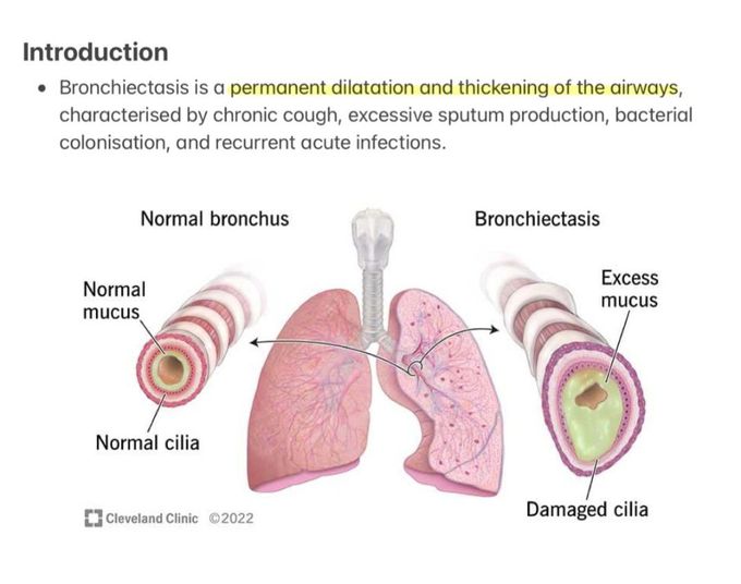 Bronchiectasis I