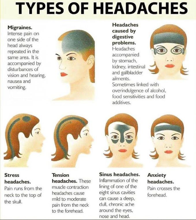 Types of headache