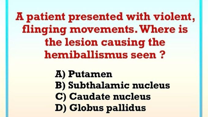 Identify the Site of Lesion