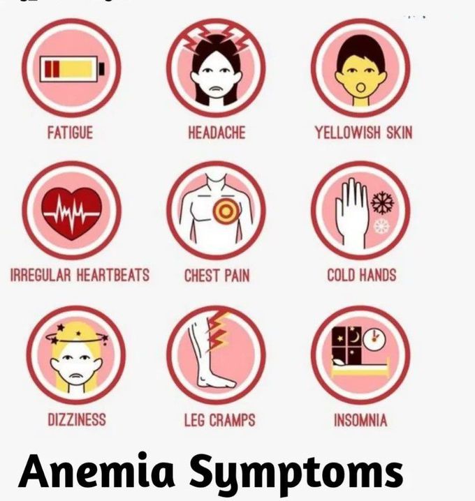 Anemia -Symptoms