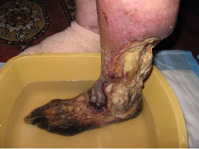 What is your diagnosis??