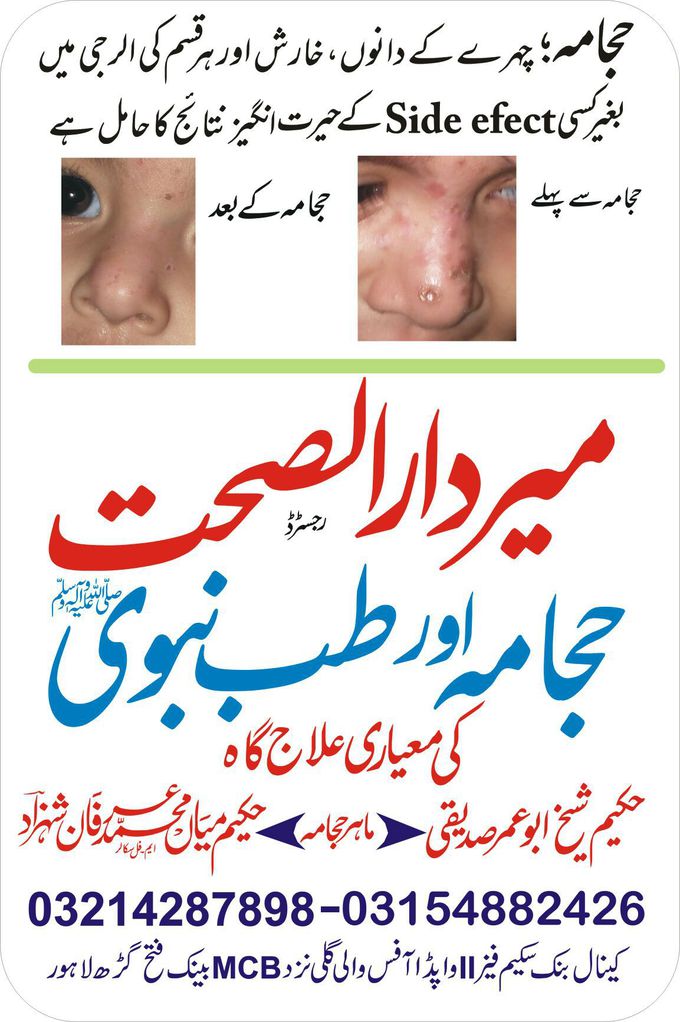 Hijama benefits in allergy and skin Decease