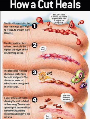 How a cut heals? - MEDizzy