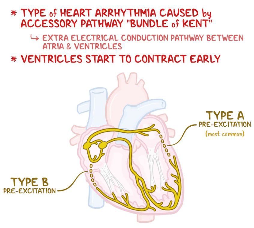 bundle of kent anatomy