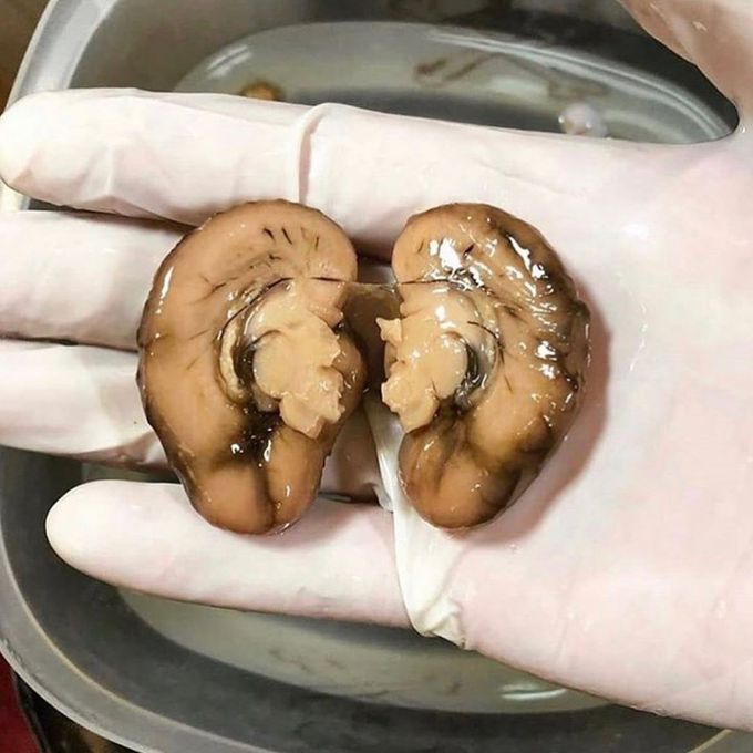 Can you identify the organ shown here? 