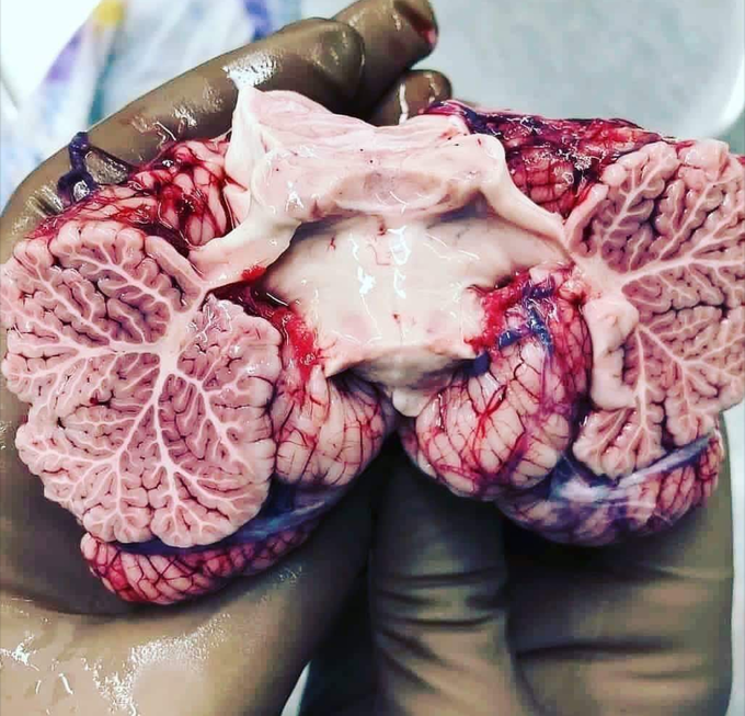 Cerebellum