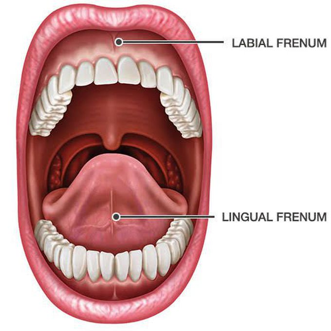 Labial frenum