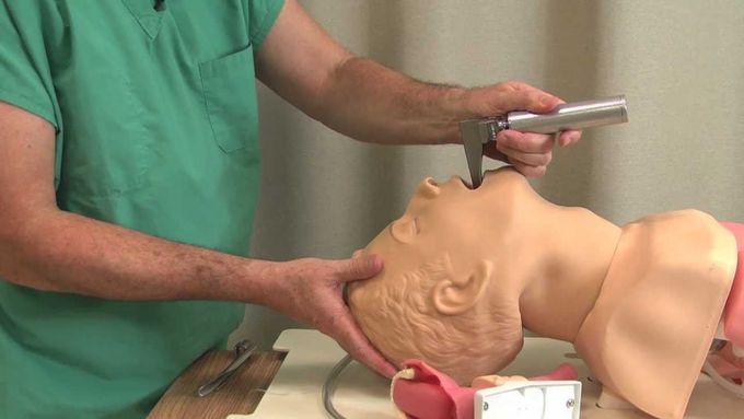Direct Laryngoscopy
