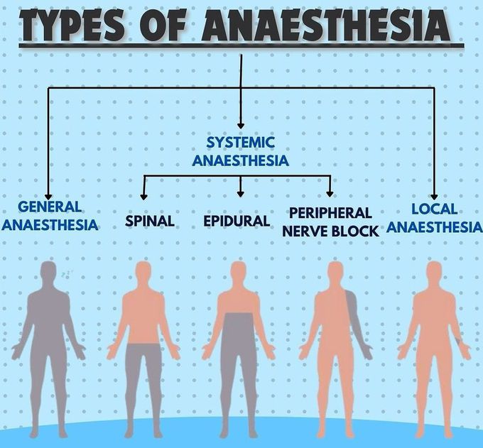 Types of Anesthesia