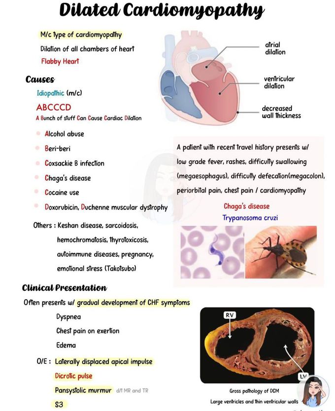 Dilated Cardiomyopathy