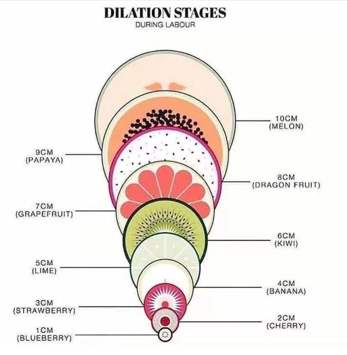 Dilation Stages of Labour