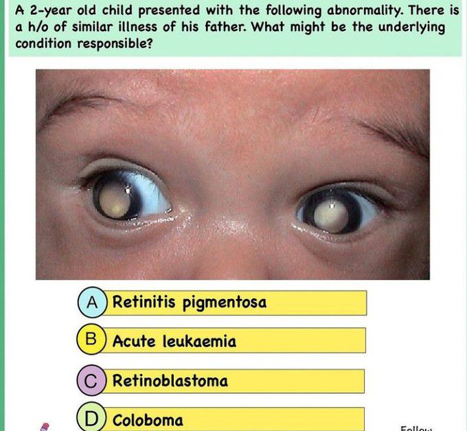 What is the diagnosis?