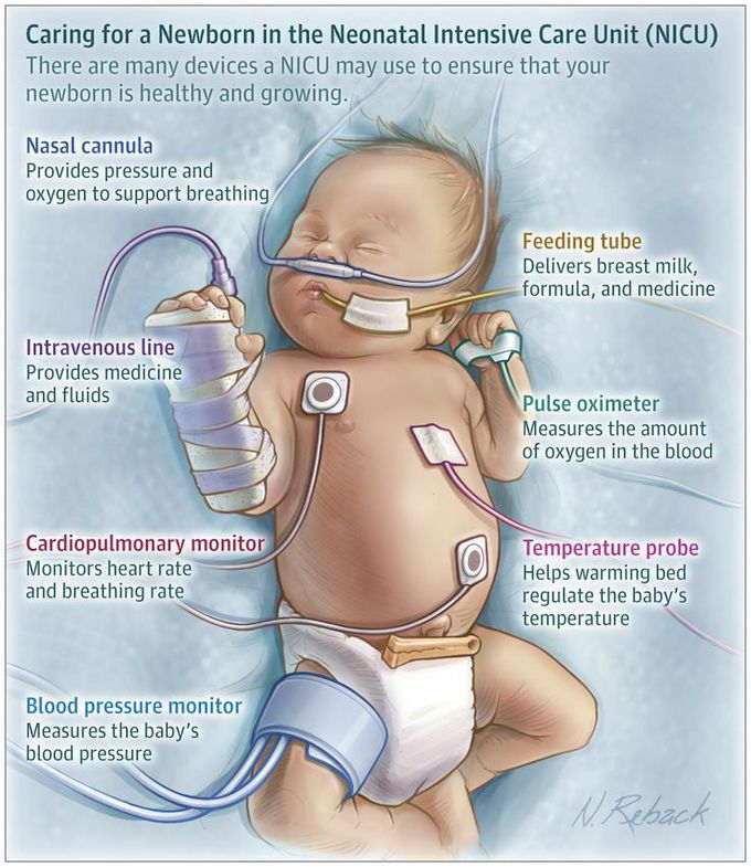 Care for a newborn in the NICU