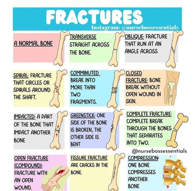 Types of fractures