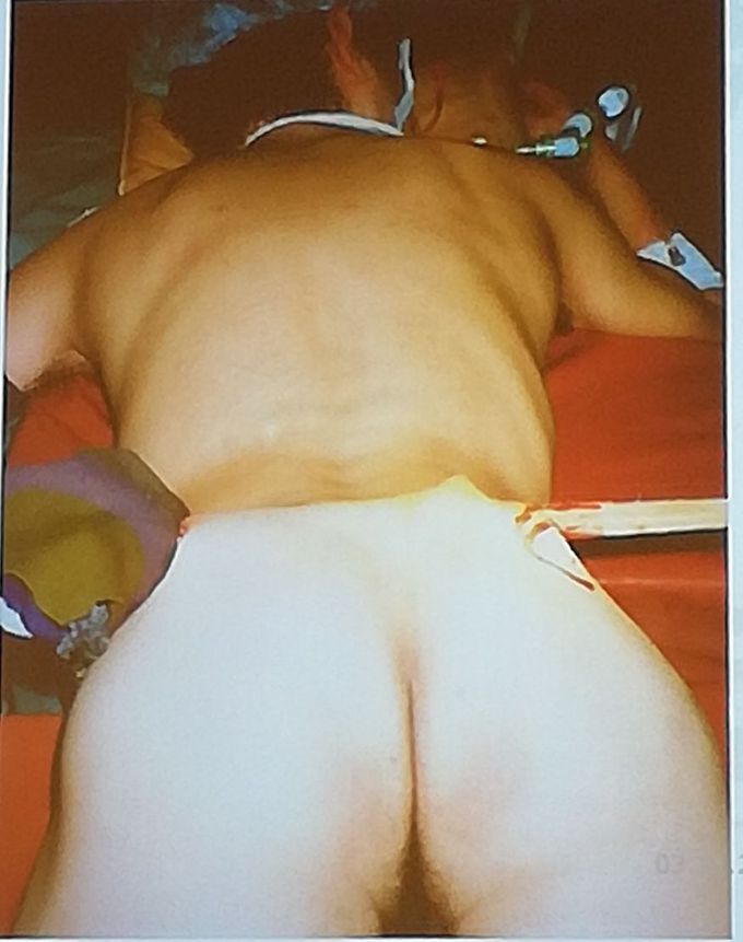 A splinter trough soft tissue