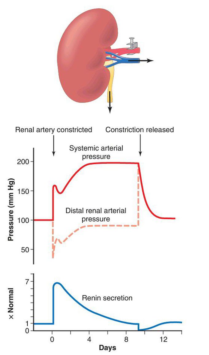 Goldblatt hypertension