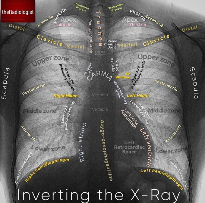 Normal CXR