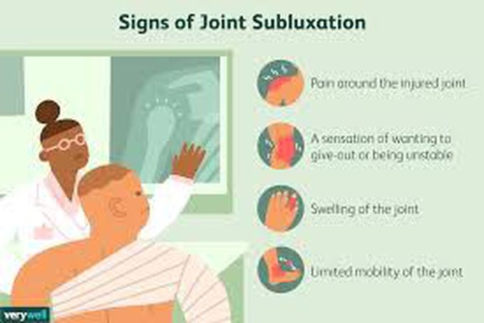 Signs of joint subluxation