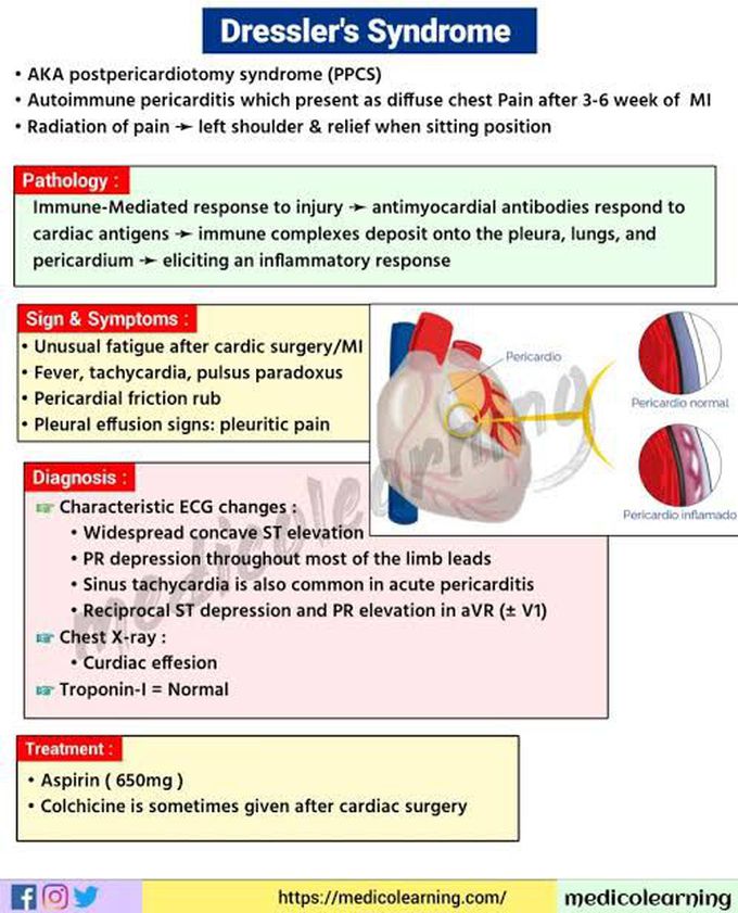 Dressler's Syndrome