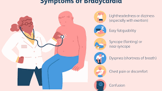 Symptoms of bradycardia