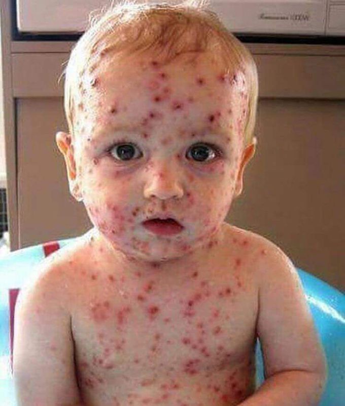 Diagnosis??