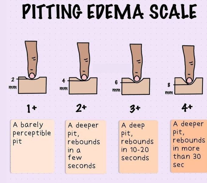 Pitting Edema