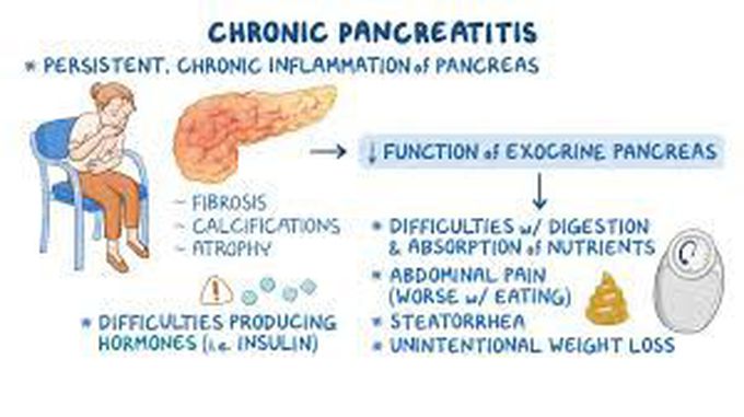 Chronic pancreatitis