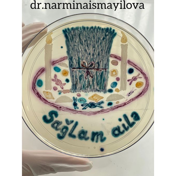 “Novruz bayram” on Chromatic ™ Detection agar