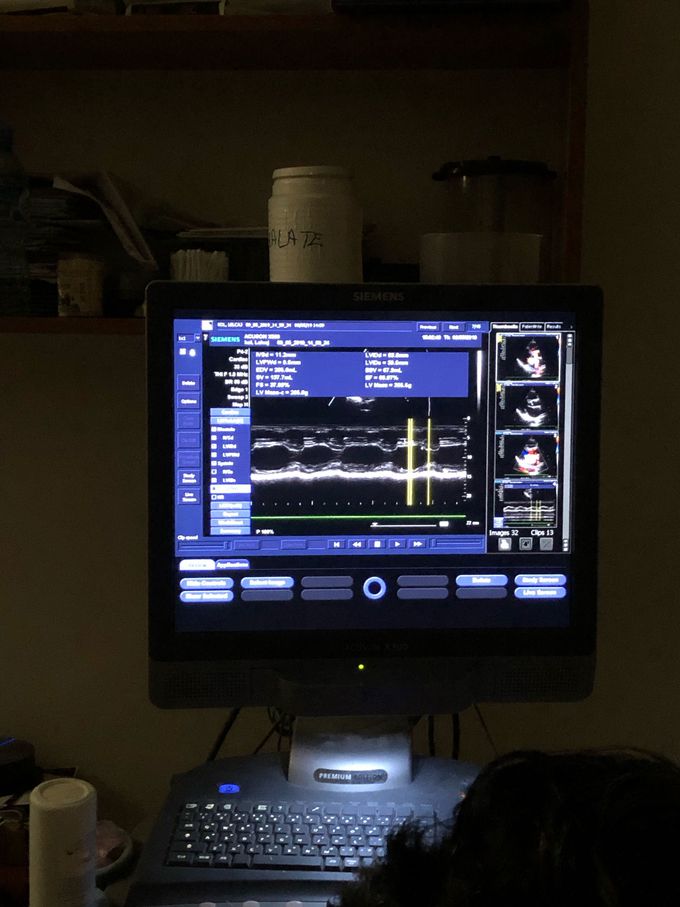 Echocardiography