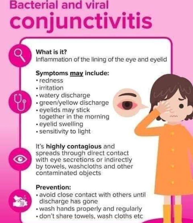 Conjunctivitis