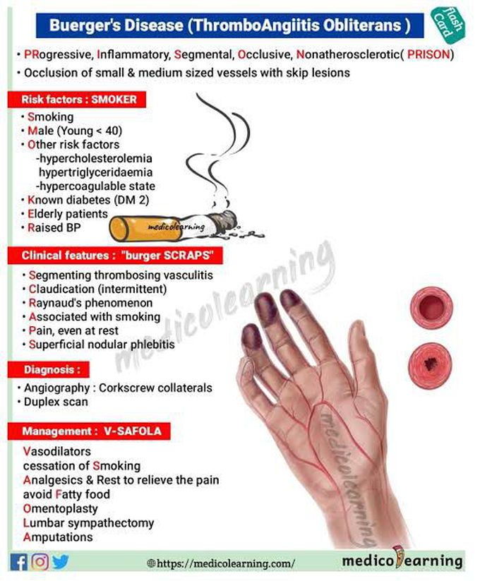 Buerger's Disease