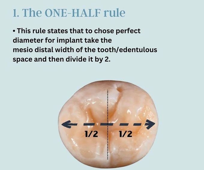 How to Choose the Correct Implant I