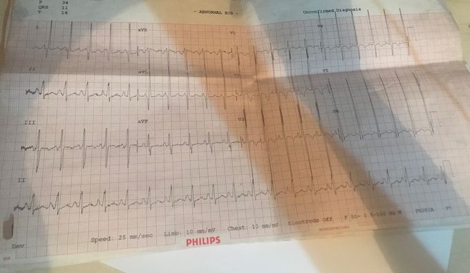 what is the diagnosis?