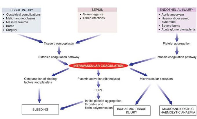 Disseminated intravascular coagulation.