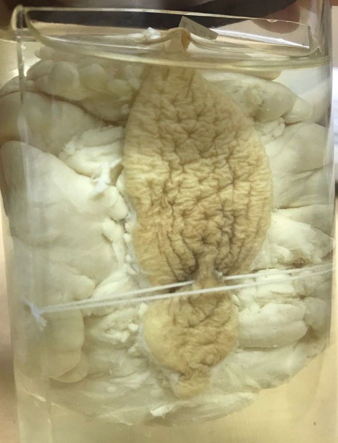 What Is The Diagnosis?